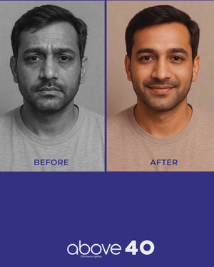 Collagen & Retinol Anti-Ageing & Brightening Night Gel Cream | For Men & Women